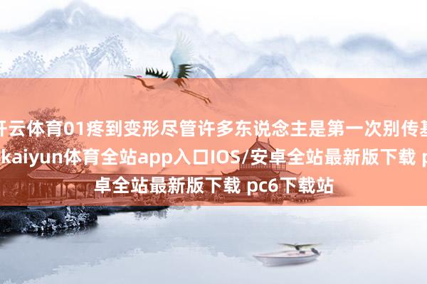 开云体育01疼到变形尽管许多东说念主是第一次别传基孔肯雅热-kaiyun体育全站app入口IOS/安卓全站最新版下载 pc6下载站